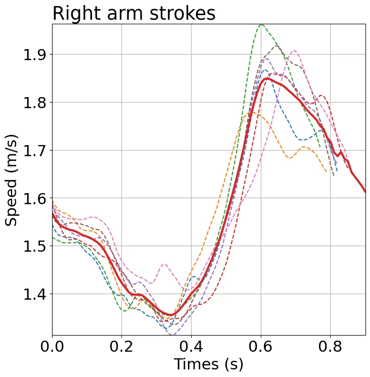 Graph of the speed changes (right arm)